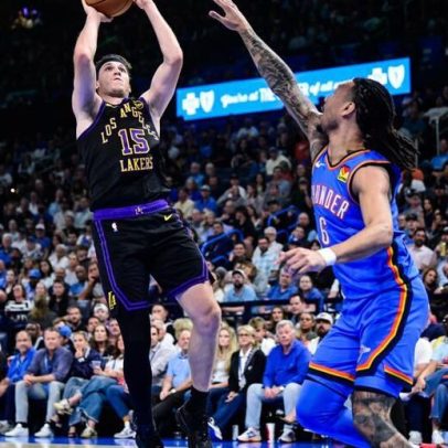 Jogador dos Lakers é comparado a Mbappé após exame feito no local errado