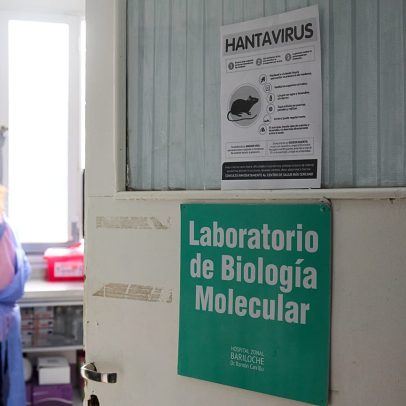 Cientistas aceleram desenvolvimento de vacina contra nova estirpe de hantavírus