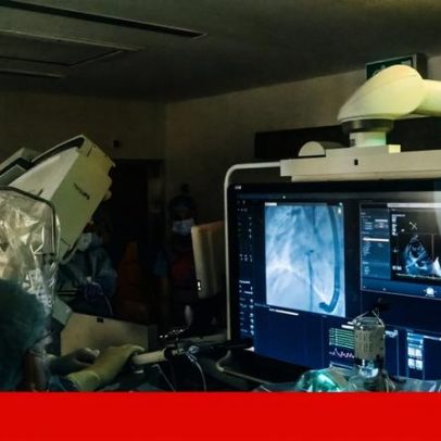 Cirurgia cardíaca: equipas recebem 80% do valor para reduzir lista de espera