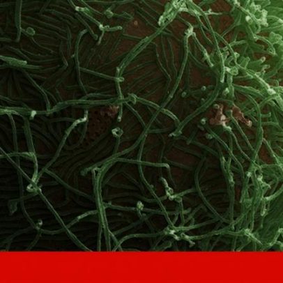Novo surto de Ébola em Bundibugyo: por que é uma emergência mundial