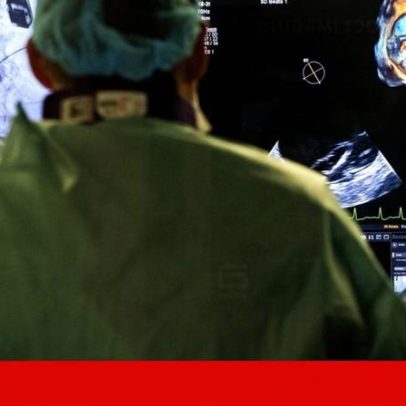 Plano de emergência na saúde: maioria das medidas concluídas, impacto menor