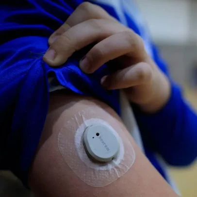 Poluição atmosférica ligada a nove milhões de casos de diabetes por ano