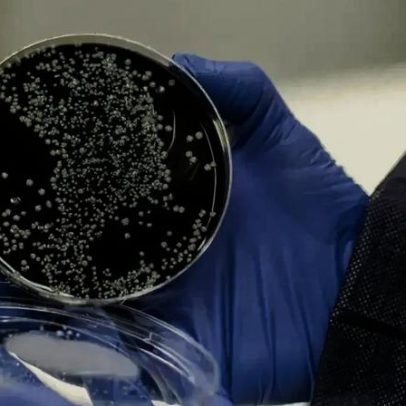 Legionella detetada numa escola de Faro