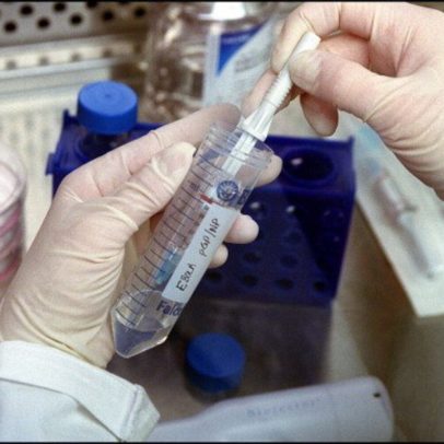 Moçambique aumenta prevenção e prontidão ante surto de Ébola na RDC