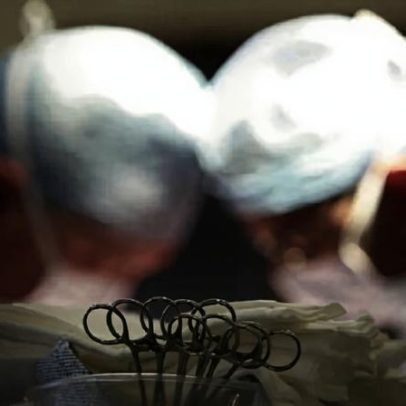 Governo paga 80% a mais por cirurgia cardíaca adicional fora do tempo