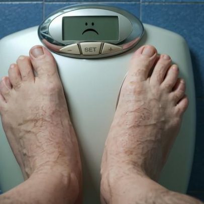 Obesidade abrandada no Ocidente, acelera em países desfavorecidos