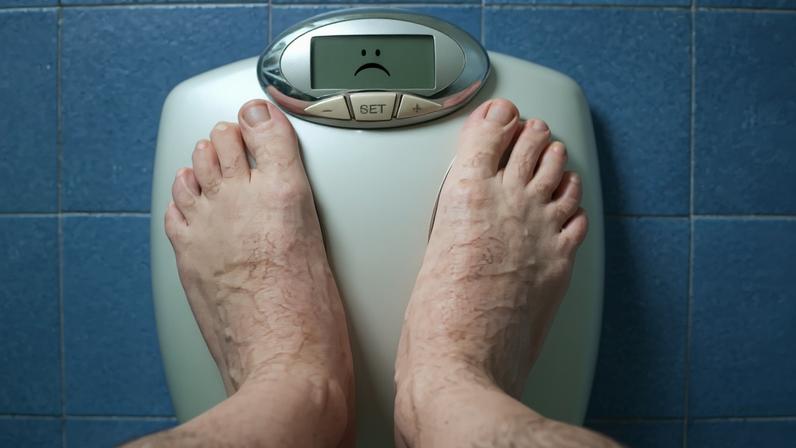 Obesidade abrandada no Ocidente, acelera em países desfavorecidos