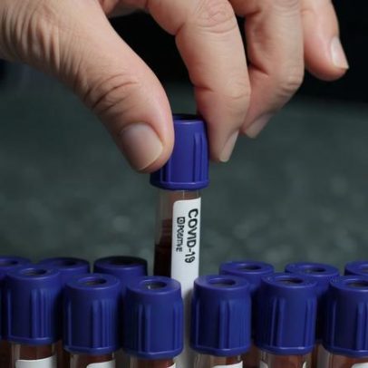 Médico norte-americano entre os casos de surto de Ébola no Congo