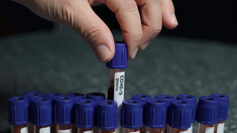 Médico americano entre os casos de surto de Ébola no Congo