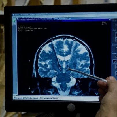 Neurocientista alerta: cérebro não consegue lidar com excesso de informação