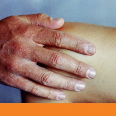 Joelhos: avanços e opções de tratamento em foco