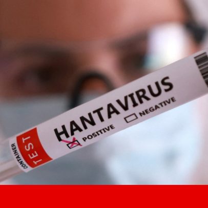 Hantavírus dos Andes: primeiros casos de transmissão entre pessoas há 30 anos