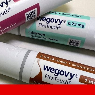 Rui perde 13 kg em um mês Portugal gasta 600 mil euros/dia em injecções de moda