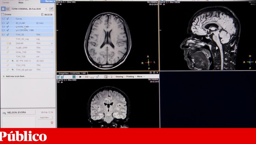 O estudo combinou avaliação genética e imagens do cérebro