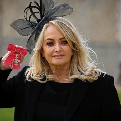 Bonnie Tyler sai do coma induzido, mas permanece em estado grave