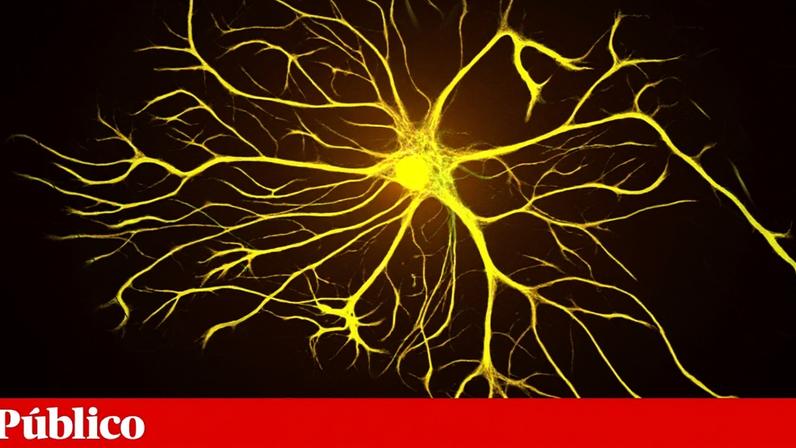 Síndrome de Down: degeneração cerebral identificada desde o nascimento