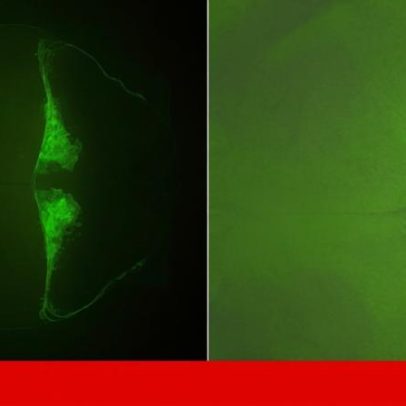 Cientistas do i3S revelam função oculta do ADN ligada a doença neurodegenerativa