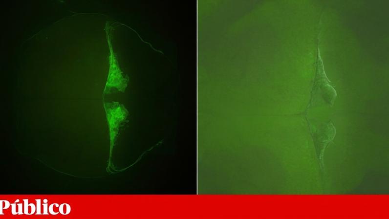 Imagem da expressão do gene *DAB1*