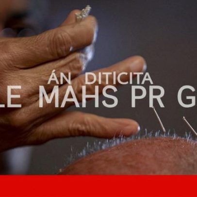 Relatos sobre ressurgimento da acupuntura são considerados exagerados