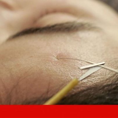 Regulador condena clínica por promover medicina integrativa; 54 centros atuam