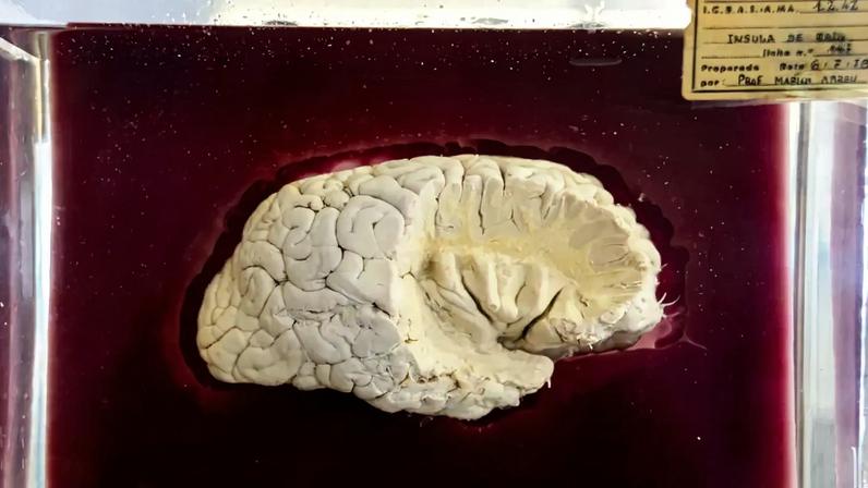 SNS vai receitar fármacos para cancro cerebral e doença neurodegenerativa