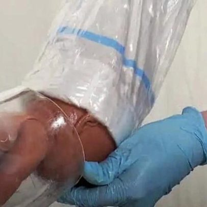 Inovação na reprodução assistida: avanços e impactos