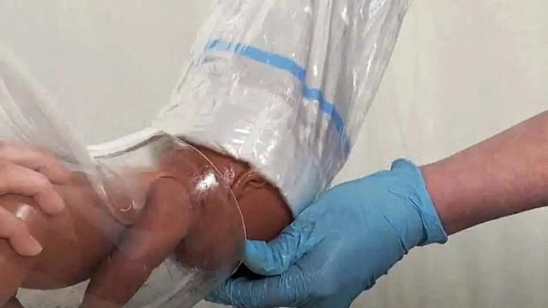 Inovação na reprodução assistida: avanços e impactos
