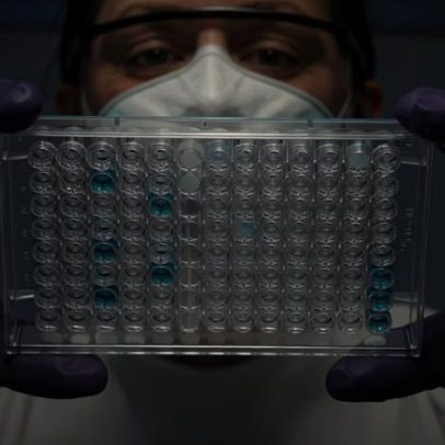 Estudo identifica proteína-chave associada a diferenças de saúde entre sexos