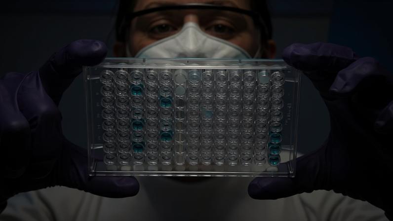 Estudo identifica proteína-chave associada a diferenças de saúde entre sexos