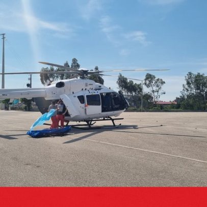 Mulher sofre queimaduras após explosão de gás numa churrasqueira em Leiria