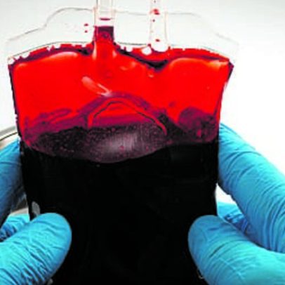Falta de meios para recolher dádivas de sangue preocupa Federação de Dadores