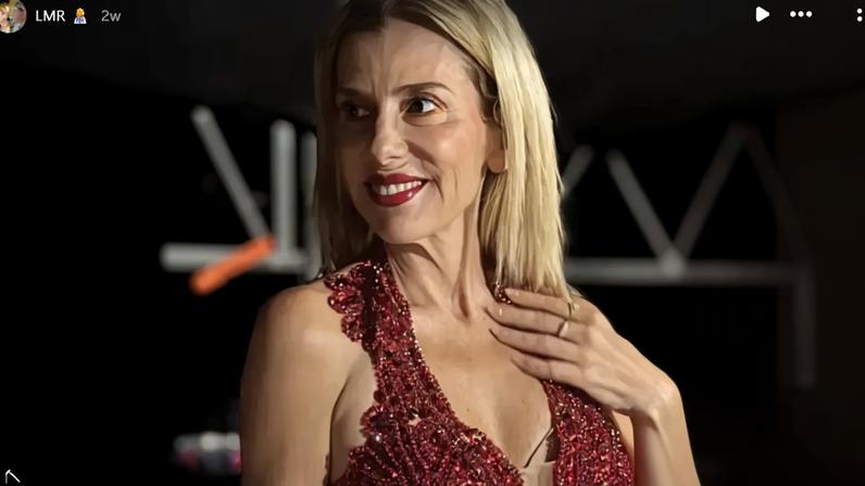 Mónica Sintra revela cirurgia facial e mostra o antes e depois