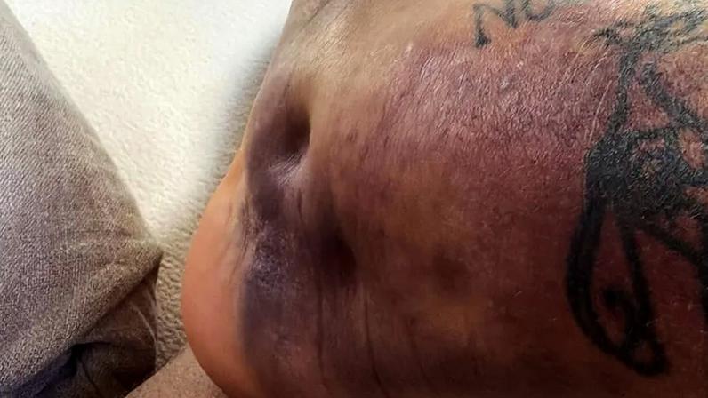 José Giménez mostra estado do tornozelo a quatro semanas do início do Mundial